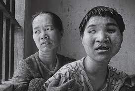 Figure 4: The after effects on the Vietnamese people